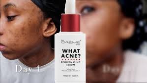 The Crème Shop "What Acne?" Hydrating & Healing Serum